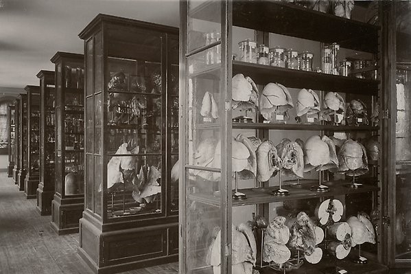 Mänskliga kvarlevor i rader av montrar i stora utställningssalen på anatomiska institutionen.