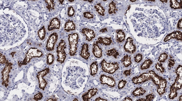 The enzyme ACE2 (in brown) expressed in the kidney. 