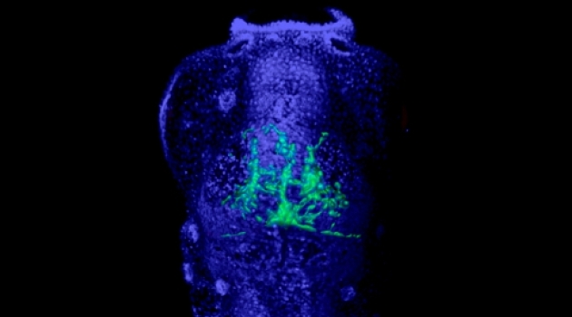 Bilden föreställer ett zebrafiskyngel med cancerceller (gröna) i nervsystemet. Forskarna använde denna typ av djurmodell för att utvärdera nya behandlingar.  