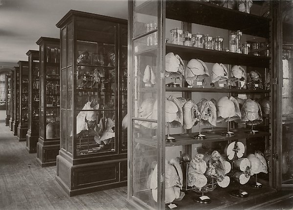 Mänskliga kvarlevor i rader av montrar i stora utsällningssalen på anatomiska institutionen.